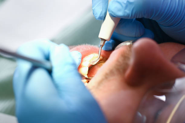Best Emergency Dental Care for Broken or Chipped Teeth in Norwood, NJ