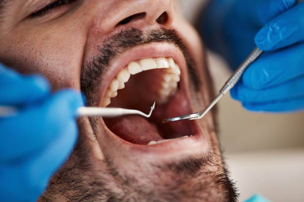 Best Same-Day Emergency Dental Services in Norwood, NJ