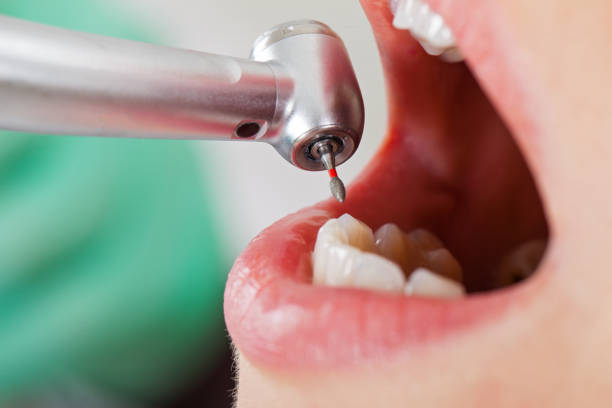 Best Cosmetic Emergency Dentistry in Norwood, NJ